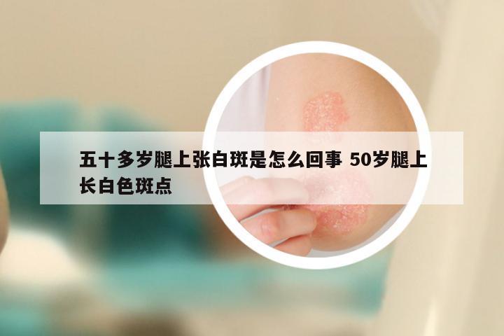 五十多岁腿上张白斑是怎么回事 50岁腿上长白色斑点