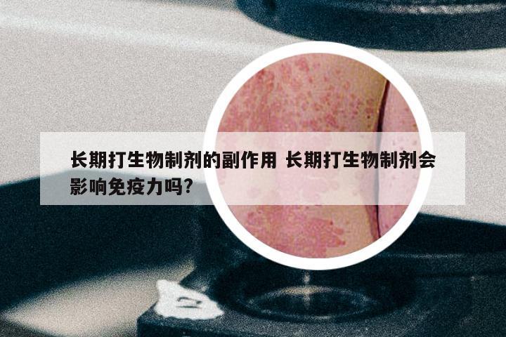 长期打生物制剂的副作用 长期打生物制剂会影响免疫力吗?