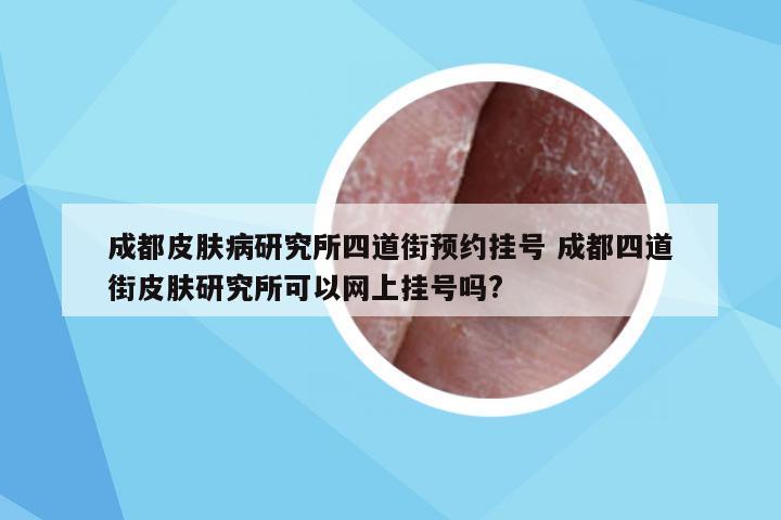 成都皮肤病研究所四道街预约挂号 成都四道街皮肤研究所可以网上挂号吗?