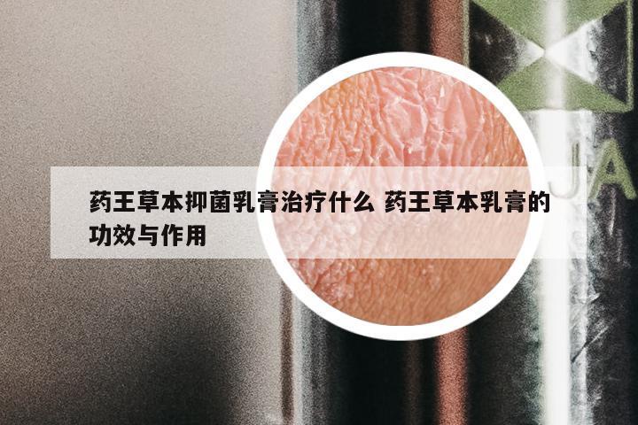 药王草本抑菌乳膏治疗什么 药王草本乳膏的功效与作用