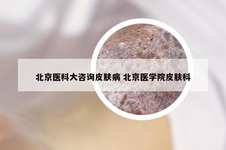 北京医科大咨询皮肤病 北京医学院皮肤科