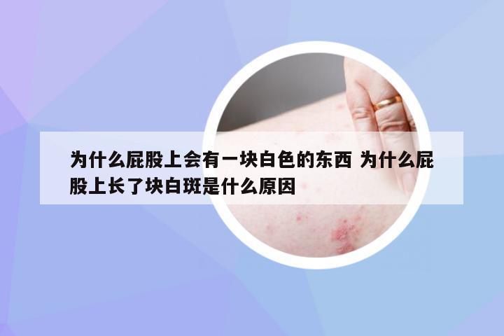 为什么屁股上会有一块白色的东西 为什么屁股上长了块白斑是什么原因