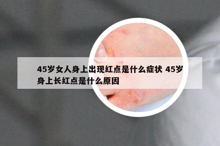 45岁女人身上出现红点是什么症状 45岁身上长红点是什么原因