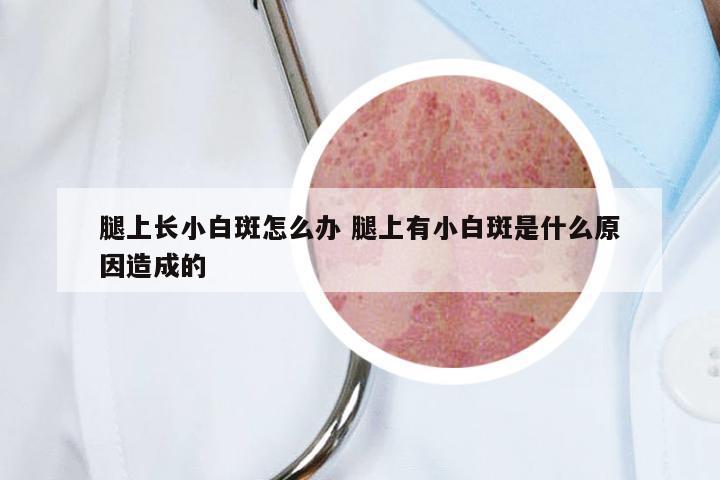 腿上长小白斑怎么办 腿上有小白斑是什么原因造成的