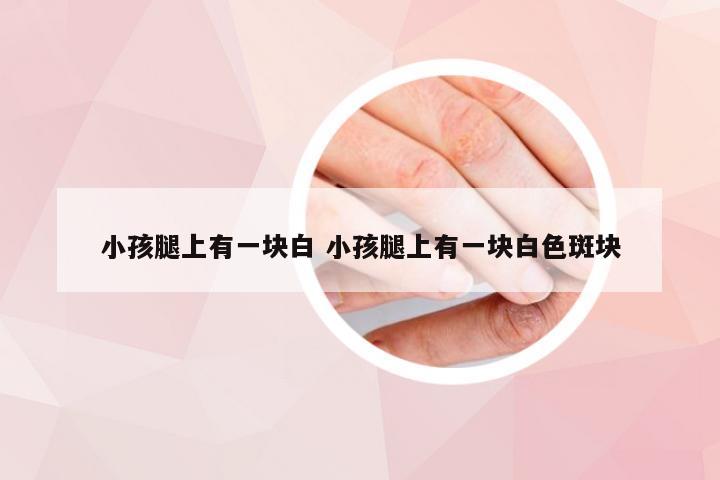 小孩腿上有一块白 小孩腿上有一块白色斑块