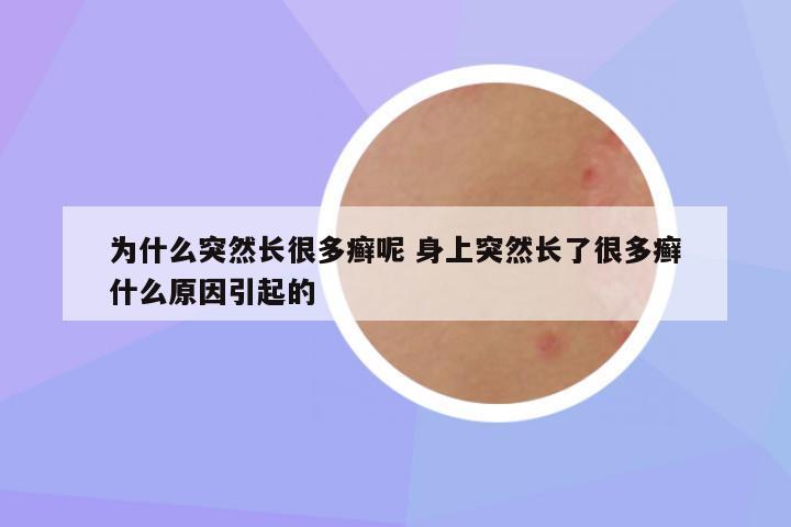 为什么突然长很多癣呢 身上突然长了很多癣什么原因引起的