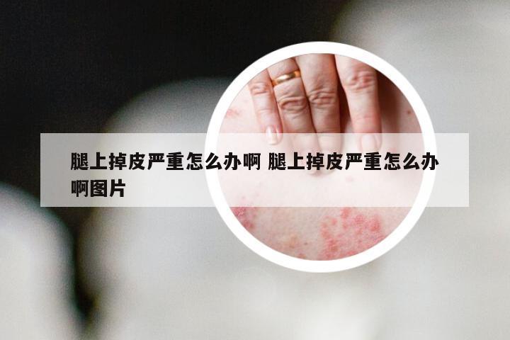 腿上掉皮严重怎么办啊 腿上掉皮严重怎么办啊图片