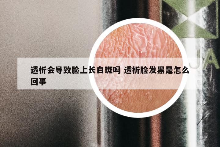 透析会导致脸上长白斑吗 透析脸发黑是怎么回事