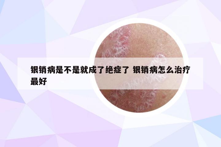 银销病是不是就成了绝症了 银销病怎么治疗最好