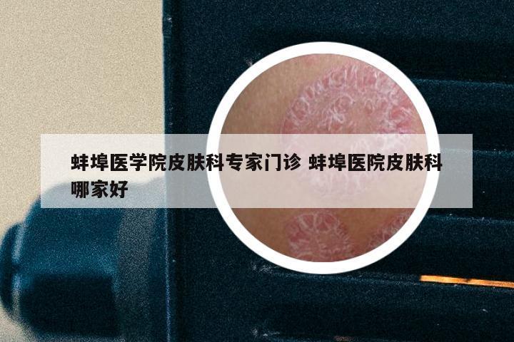 蚌埠医学院皮肤科专家门诊 蚌埠医院皮肤科哪家好