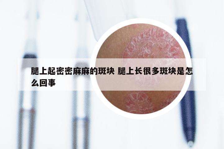 腿上起密密麻麻的斑块 腿上长很多斑块是怎么回事