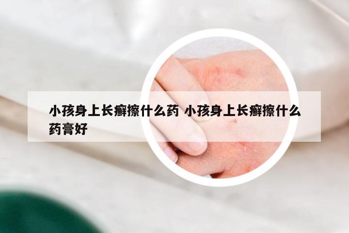 小孩身上长癣擦什么药 小孩身上长癣擦什么药膏好