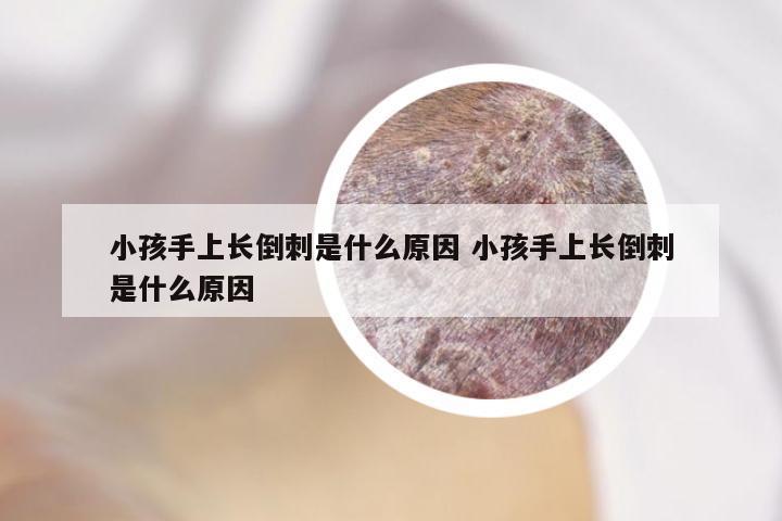 小孩手上长倒刺是什么原因 小孩手上长倒刺是什么原因