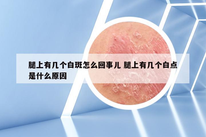 腿上有几个白斑怎么回事儿 腿上有几个白点是什么原因