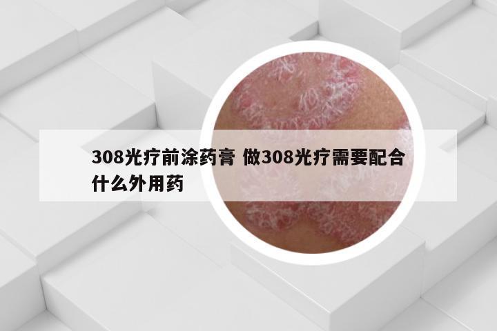 308光疗前涂药膏 做308光疗需要配合什么外用药