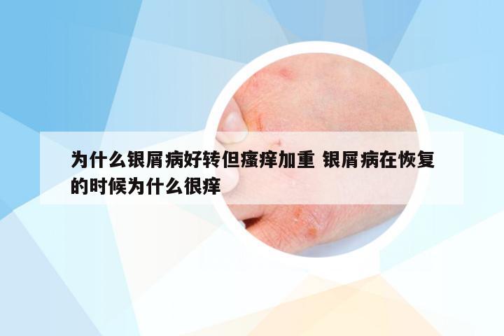 为什么银屑病好转但瘙痒加重 银屑病在恢复的时候为什么很痒