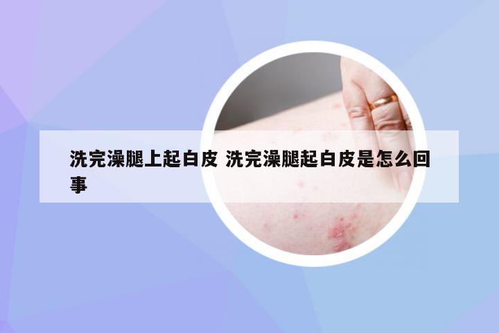 洗完澡腿上起白皮 洗完澡腿起白皮是怎么回事