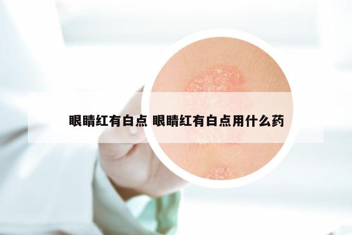 眼睛红有白点 眼睛红有白点用什么药