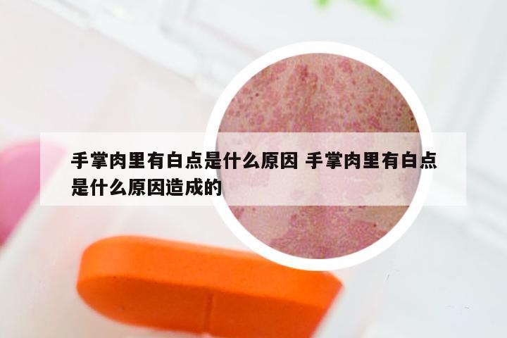 手掌肉里有白点是什么原因 手掌肉里有白点是什么原因造成的