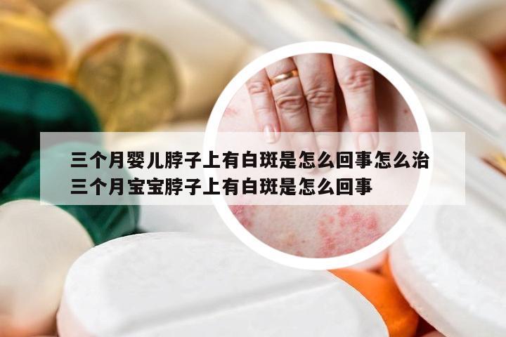 三个月婴儿脖子上有白斑是怎么回事怎么治 三个月宝宝脖子上有白斑是怎么回事