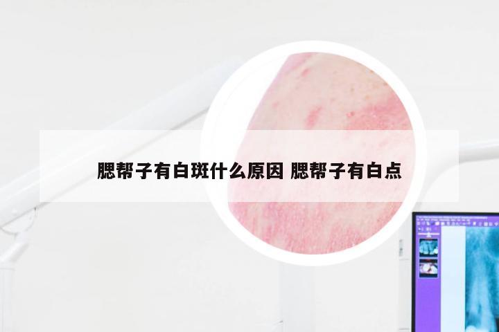 腮帮子有白斑什么原因 腮帮子有白点