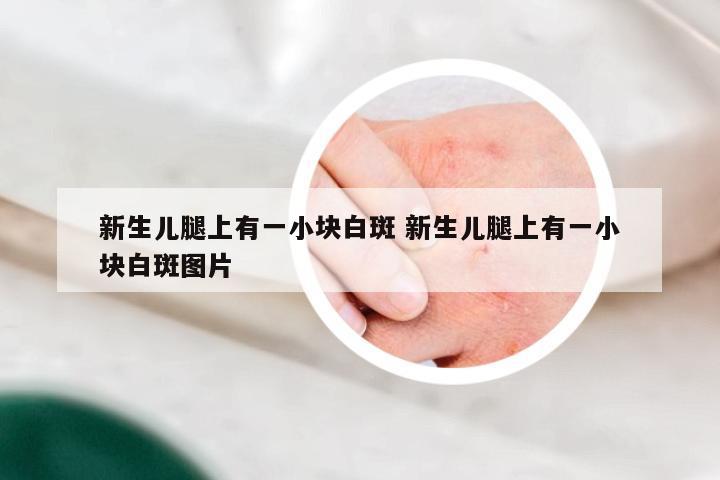 新生儿腿上有一小块白斑 新生儿腿上有一小块白斑图片