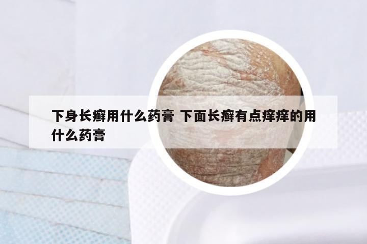 下身长癣用什么药膏 下面长癣有点痒痒的用什么药膏