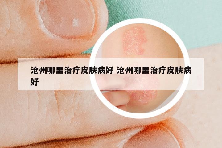 沧州哪里治疗皮肤病好 沧州哪里治疗皮肤病好