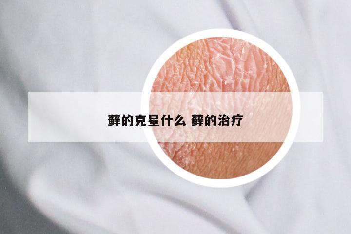 藓的克星什么 藓的治疗