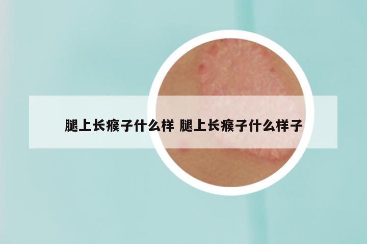 腿上长瘊子什么样 腿上长瘊子什么样子