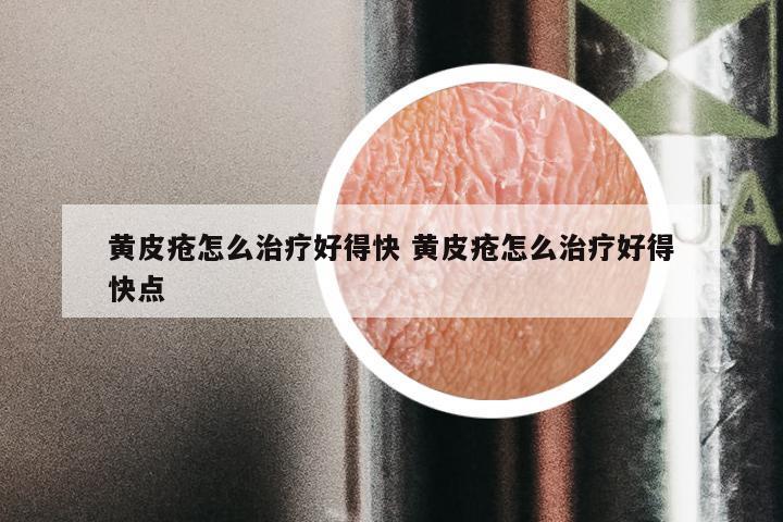 黄皮疮怎么治疗好得快 黄皮疮怎么治疗好得快点