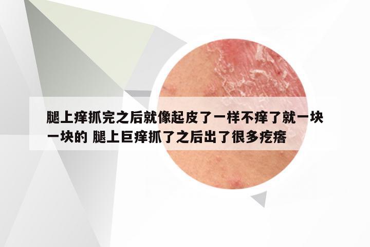 腿上痒抓完之后就像起皮了一样不痒了就一块一块的 腿上巨痒抓了之后出了很多疙瘩