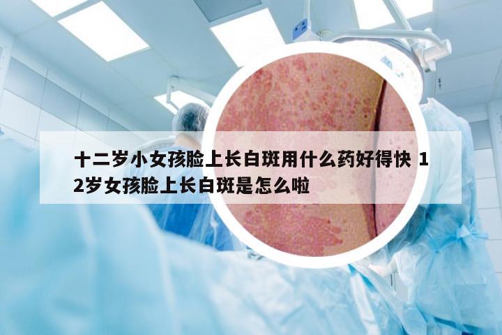 十二岁小女孩脸上长白斑用什么药好得快 12岁女孩脸上长白斑是怎么啦