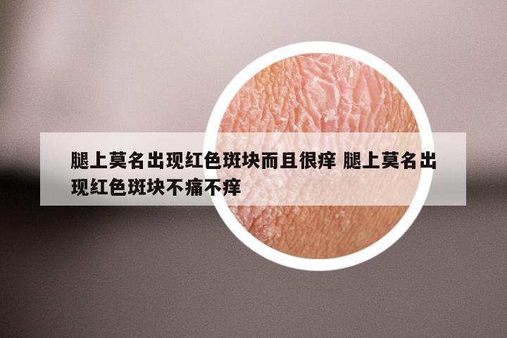 腿上莫名出现红色斑块而且很痒 腿上莫名出现红色斑块不痛不痒