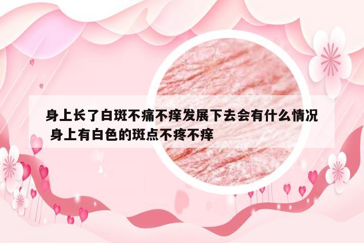 身上长了白斑不痛不痒发展下去会有什么情况 身上有白色的斑点不疼不痒