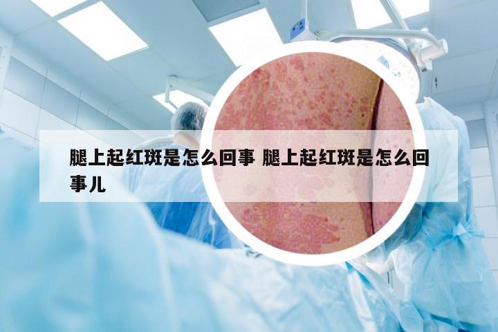 腿上起红斑是怎么回事 腿上起红斑是怎么回事儿