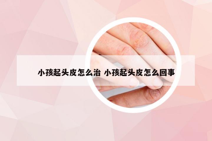 小孩起头皮怎么治 小孩起头皮怎么回事