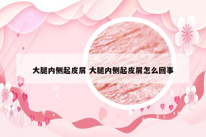 大腿内侧起皮屑 大腿内侧起皮屑怎么回事