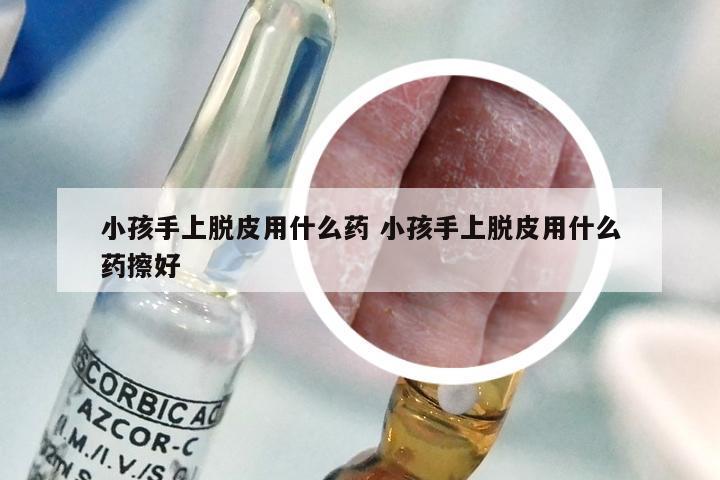 小孩手上脱皮用什么药 小孩手上脱皮用什么药擦好