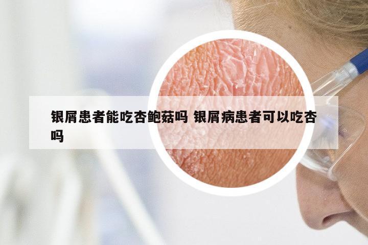 银屑患者能吃杏鲍菇吗 银屑病患者可以吃杏吗