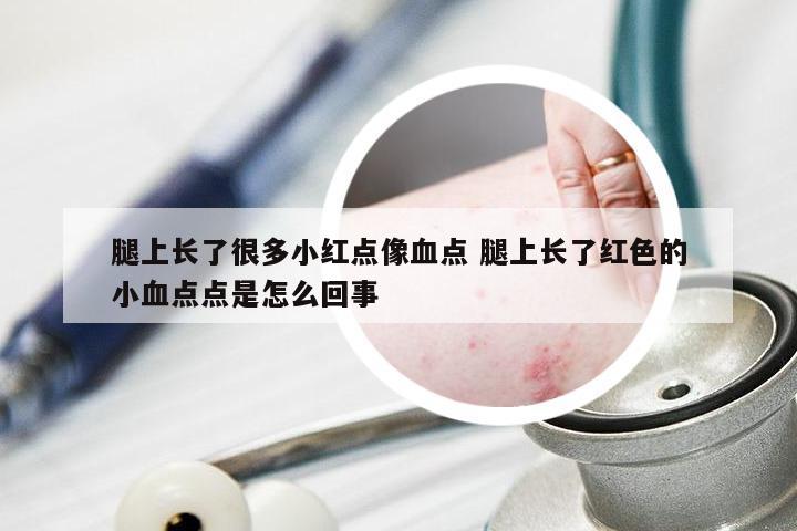 腿上长了很多小红点像血点 腿上长了红色的小血点点是怎么回事