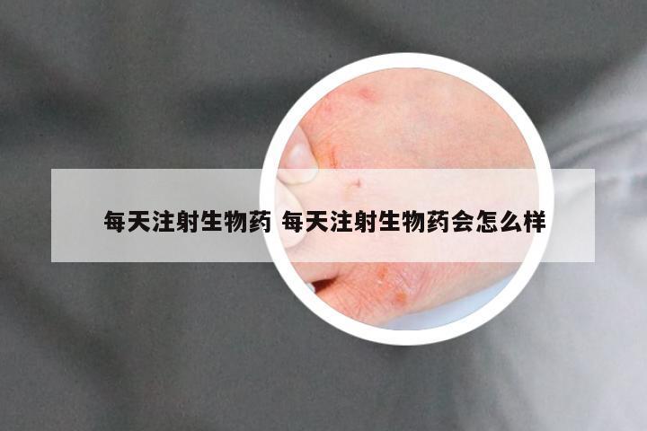 每天注射生物药 每天注射生物药会怎么样