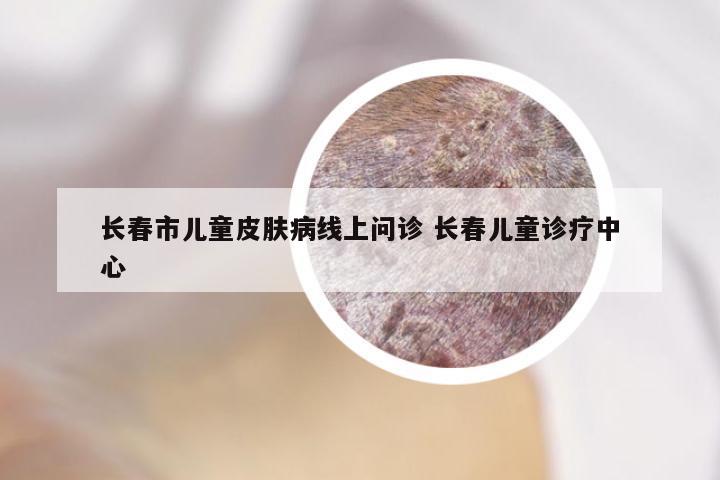 长春市儿童皮肤病线上问诊 长春儿童诊疗中心