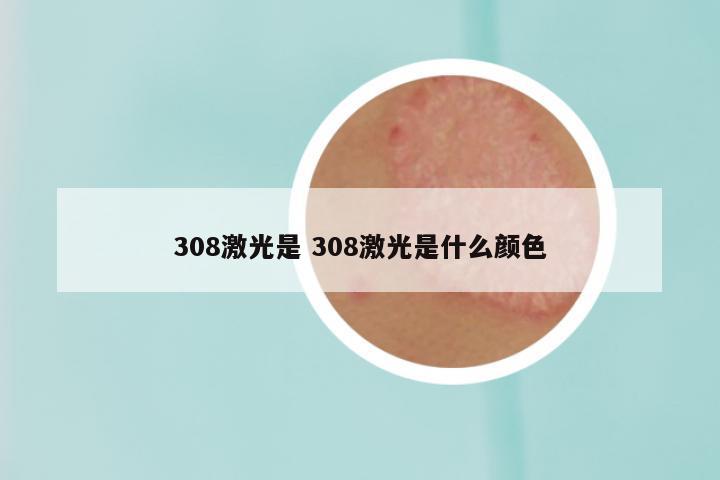 308激光是 308激光是什么颜色