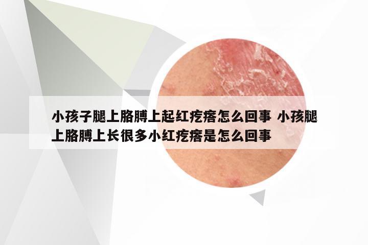 小孩子腿上胳膊上起红疙瘩怎么回事 小孩腿上胳膊上长很多小红疙瘩是怎么回事