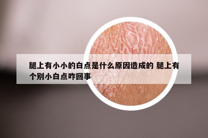 腿上有小小的白点是什么原因造成的 腿上有个别小白点咋回事