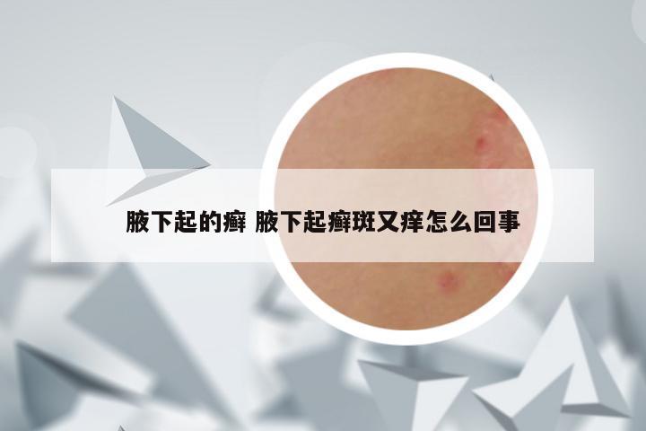 腋下起的癣 腋下起癣斑又痒怎么回事