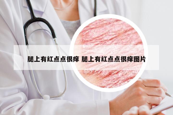 腿上有红点点很痒 腿上有红点点很痒图片