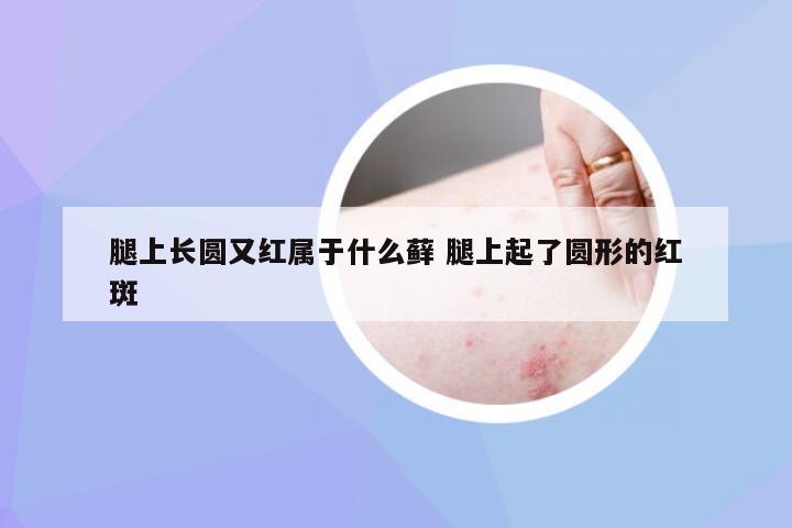 腿上长圆又红属于什么藓 腿上起了圆形的红斑