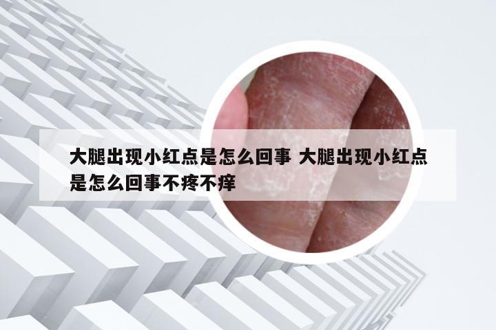 大腿出现小红点是怎么回事 大腿出现小红点是怎么回事不疼不痒